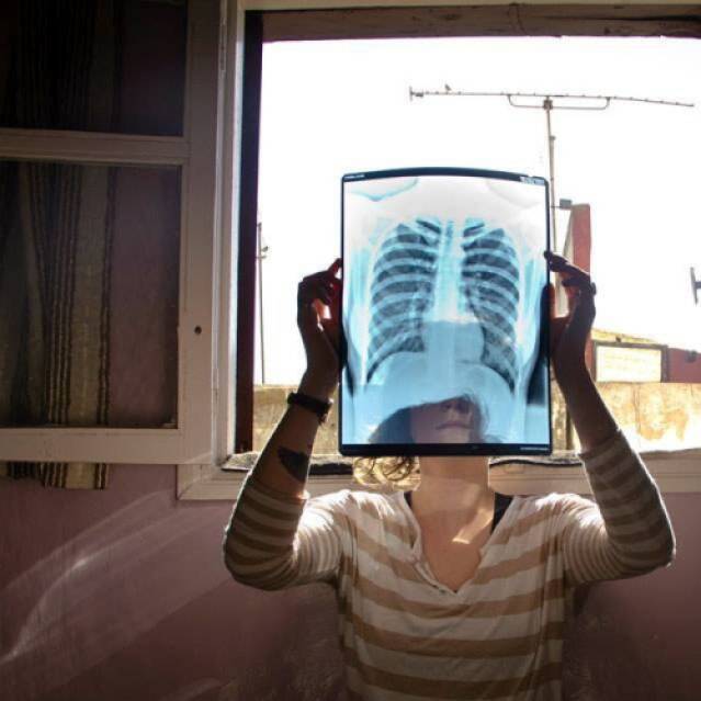 Study abroad student looks at x-ray of someone's chest in front of a window